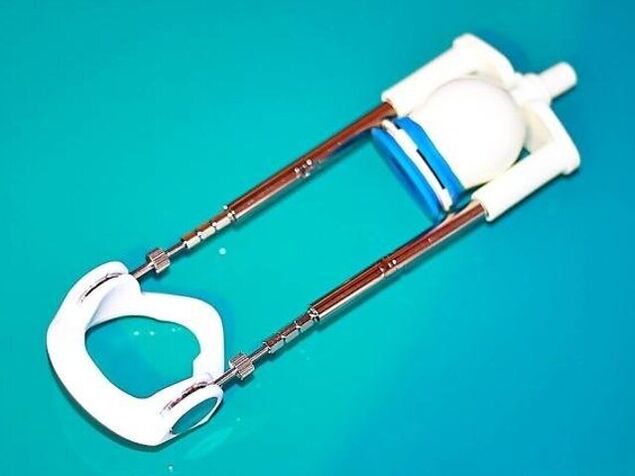 Για να επιμηκύνετε τον φαλλό, μπορείτε να χρησιμοποιήσετε μια ειδική συσκευή - μια επέκταση.